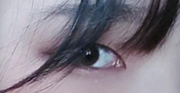 >>6 어떻게 생겨야 심한건지 모르겟어서... 사진첨부함...