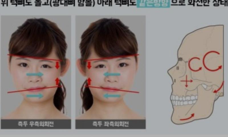 찾아보니까 이 상태인 듯..ㅋ...ㅋㅋ..ㅠ