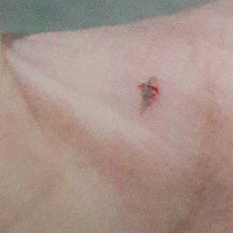 약혐주의 ㅈㅅ 화질얹종ㅎ아 그건그렇고 지짜너무아파 엄짇검지사이에 그 ㅏ니 어쟀든아파아프다고
