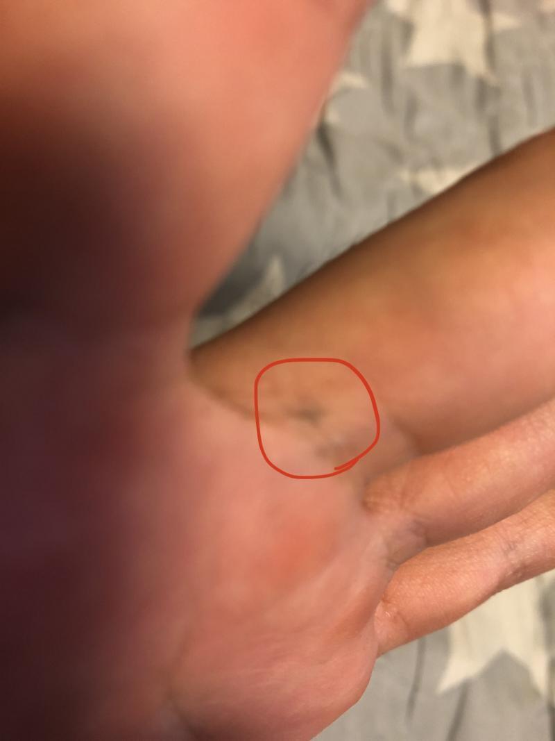 초등학교때 연필에 찍힌거 10년도 넘었는데 아직도 남아있어