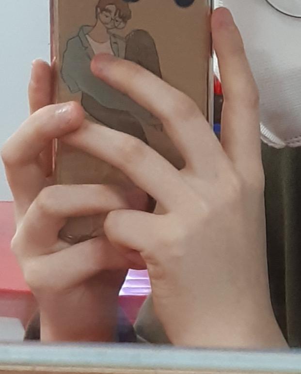 얘들아 오랜만이여. 나 교정해서 손톱 물어뜯는거 고쳤어!! 별차이 없어서 물어 뜯을때랑 고친지금 손 사진 같이 올릴게! 1번째 사진은 물어뜯을때
