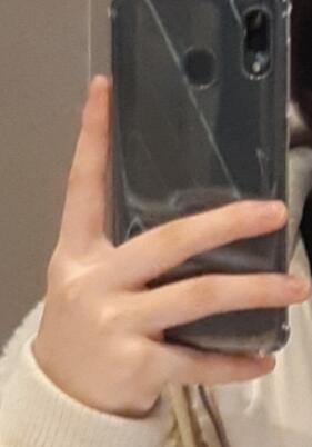 얘들아 오랜만이여. 나 교정해서 손톱 물어뜯는거 고쳤어!! 별차이 없어서 물어 뜯을때랑 고친지금 손 사진 같이 올릴게! 1번째 사진은 물어뜯을때