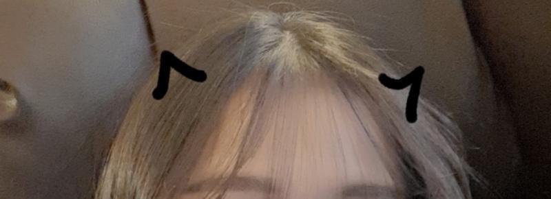 헤어라인에 머리숱이 적어서 걍 편하게있으면 1번사진 처럼되서 이마 너무 넓어보여가지고 짜증나ㅠㅜㅠ 좀 고데기 열심히하고 옆으로 퍼뜨리면? 3번째