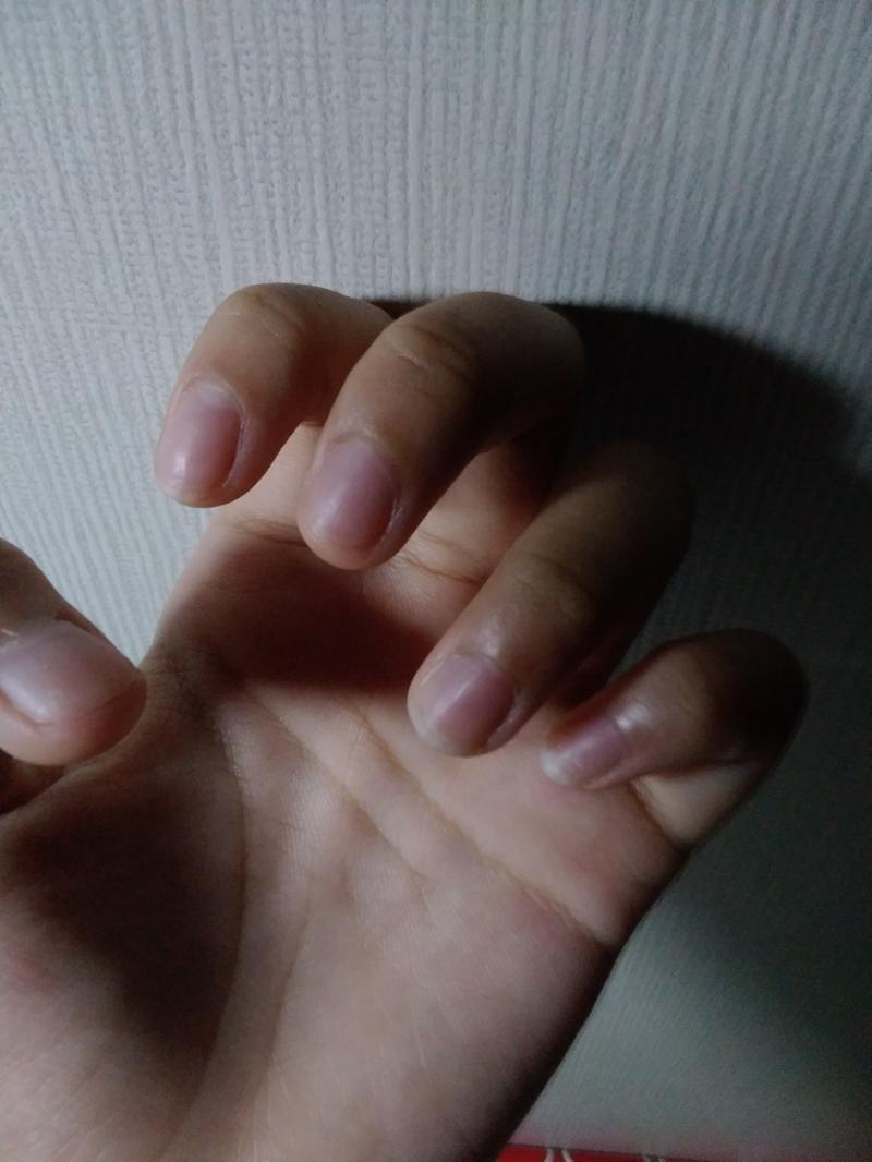 >>7 일단 내 손톱 올려볼게 지금은 매니큐어 다 뜯어버림... 내일 발라야지