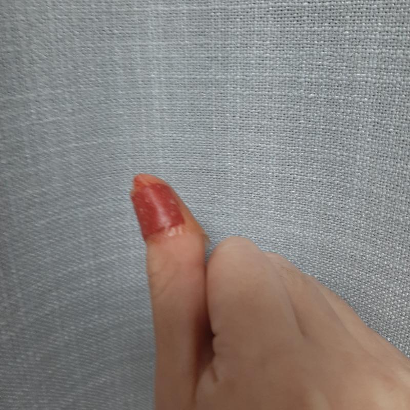 피 주의!! 피 못보는 사람은 보지 말것 내 손꾸락 밴드붙인 사진이긴 한데 그래도 조심해서 열어!! 밴드 붙인지 5분도 안됐는데 이렇게 됐어..