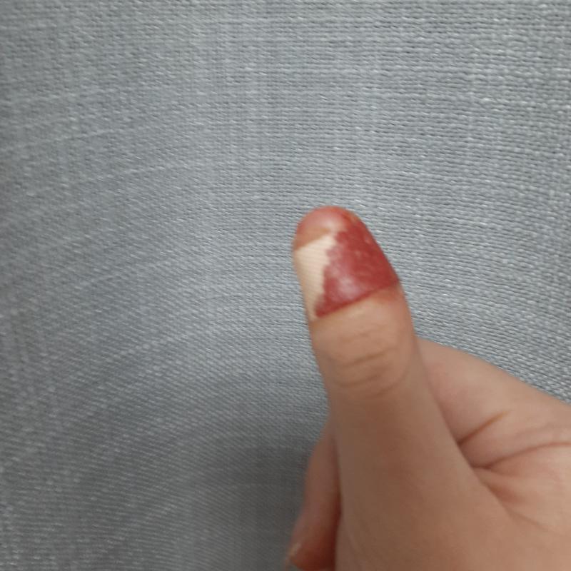 피 주의!! 피 못보는 사람은 보지 말것 내 손꾸락 밴드붙인 사진이긴 한데 그래도 조심해서 열어!! 밴드 붙인지 5분도 안됐는데 이렇게 됐어..