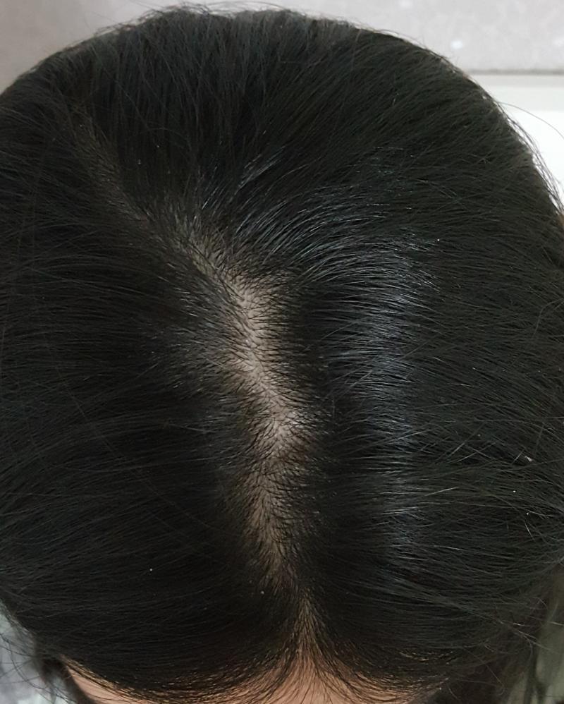 씻기 전이라 비듬보이는데 미안행