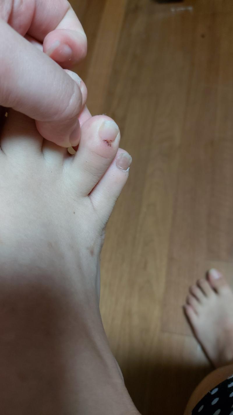 인증사진. 근데 사람에 따라 혐짤일 수 있으니 주의!