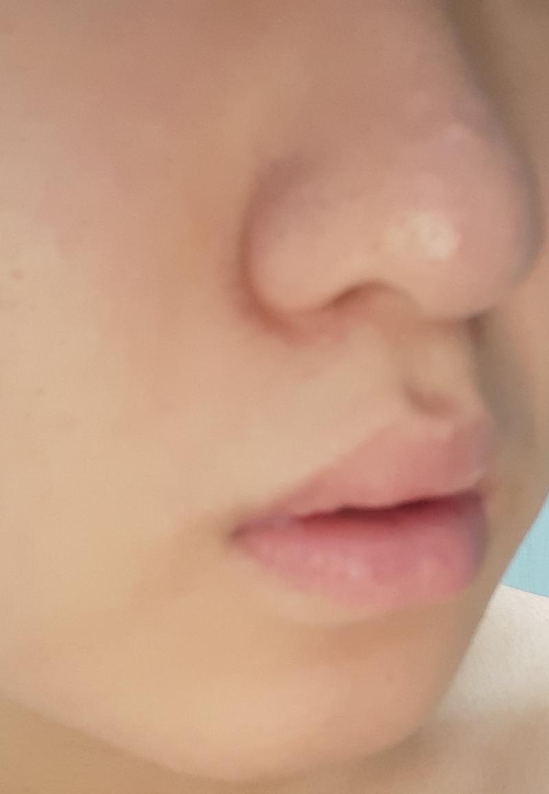 i know....impossible.... 코끝이 ㅈㄴ크다...메부리코다...그냥 코 자체가 크닷ㅂ.....마사지 효과 본 거 있으면 좀 te