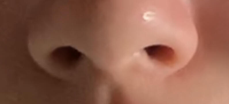 내 양쪽 콧구멍 근황이다 >>6 저거랑 비슷한거 같다.. 이거 어캐 못하냐 ㅠㅜㅜㅜㅠㅠ 하
