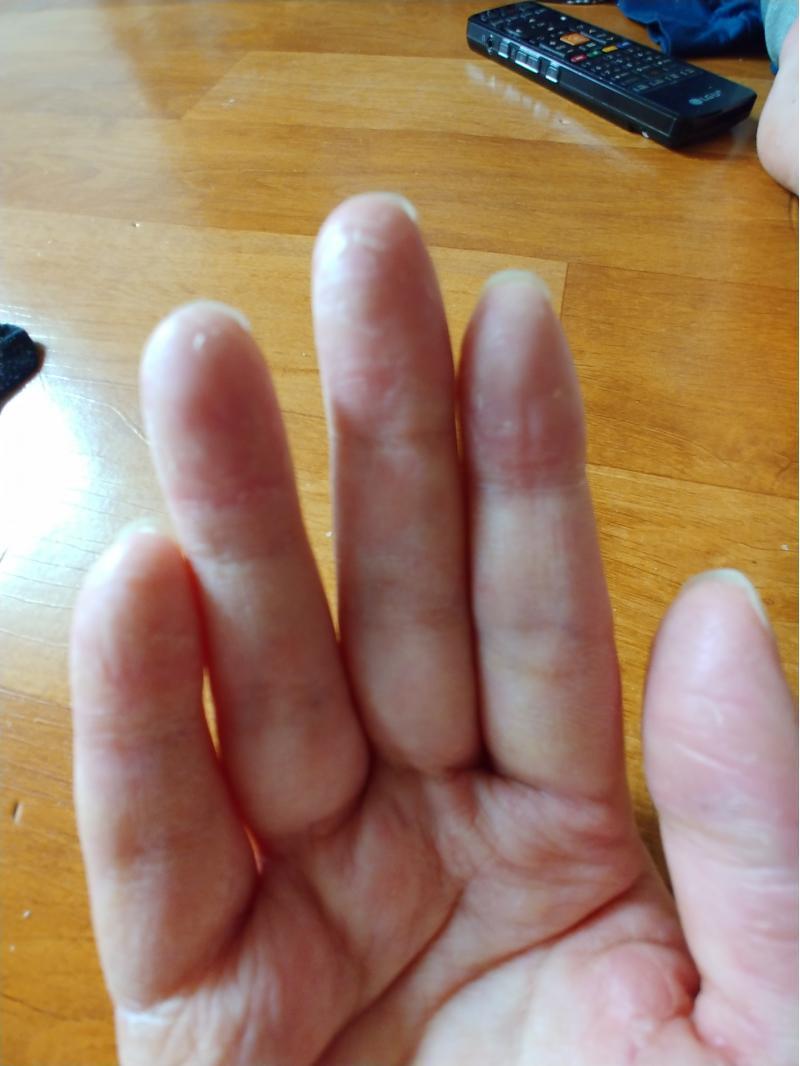 내 피부 ㅠㅜ