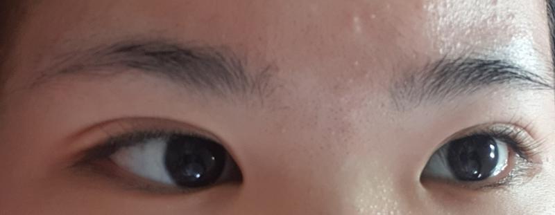 >>5 여기!! 여드름은 무시해죠..