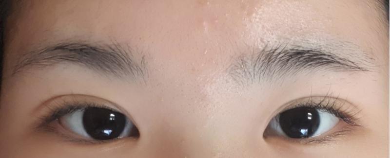 >>5 여기!! 여드름은 무시해죠..