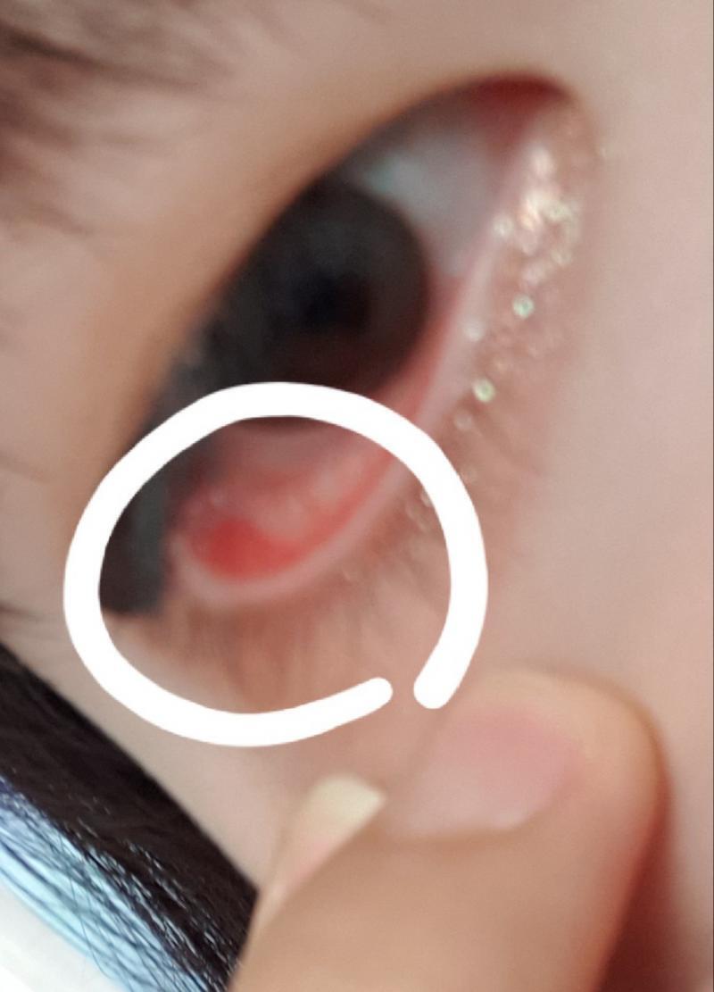 최댜한 빨리 알려줘ㅡㅜㅠ