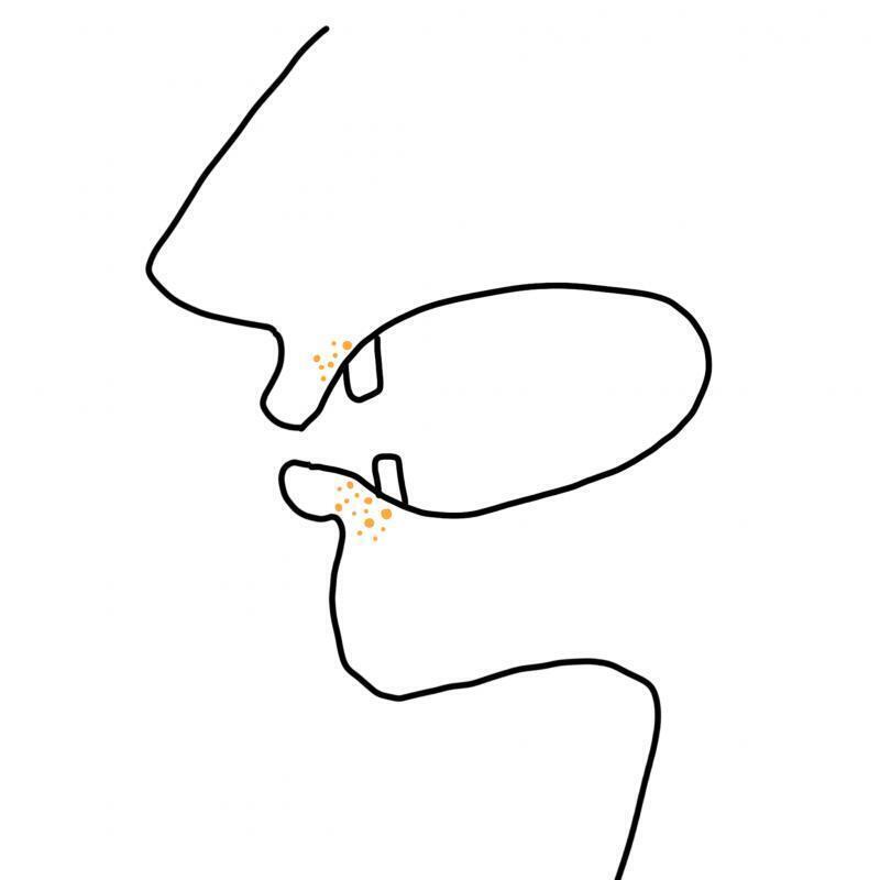 얘드라 내가 입 안쪽에 이빨앞에.. 잎술밑에 뭐가 계속 느껴지는데 말로하기 힘드니 그림 첨부할게! 딱 저 부분 쯤에서 안에 동글동글한 뭐가 가득