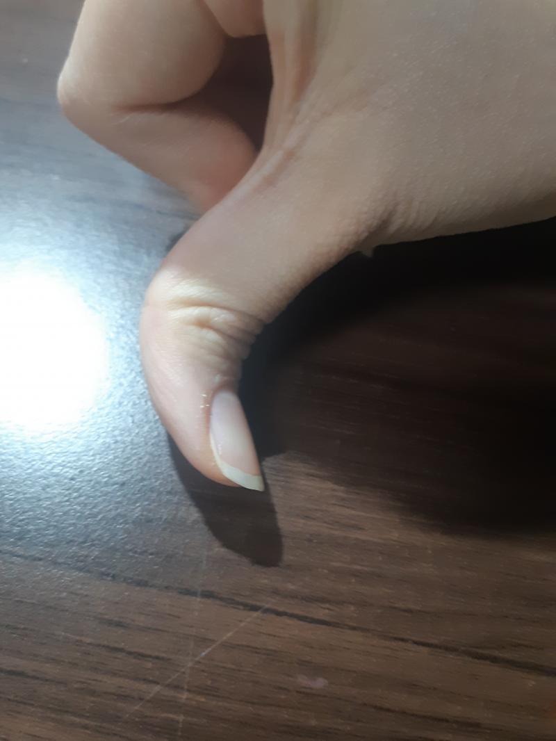 손등 정 중앙이랑 배꼽 바로 위에 점이 똭 있어. 양쪽 엄지손가락들이 사진처럼 구부리기 가능하다...?(손가락으로 밀면 더 뒤로 구부러져) 이건
