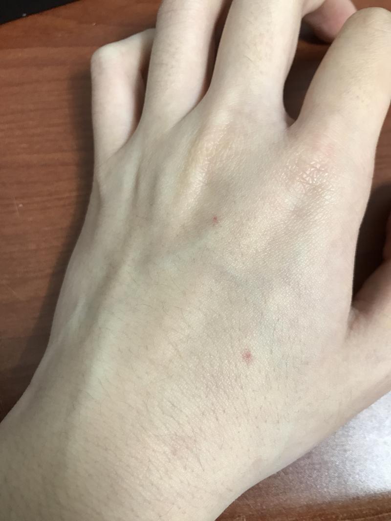 혹시나 혈점을 모르는 사람이 있을까 해서