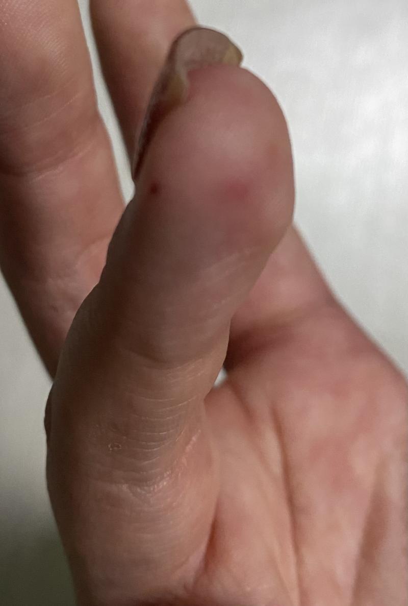 이거야ㅠ손톱은 때낀거같지만 젤네일...