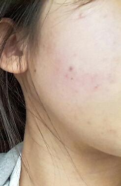 조금 혐오스러ㅜ