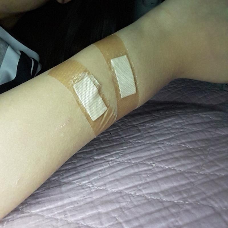지금 장난아니야,,,, 연고 바르고
