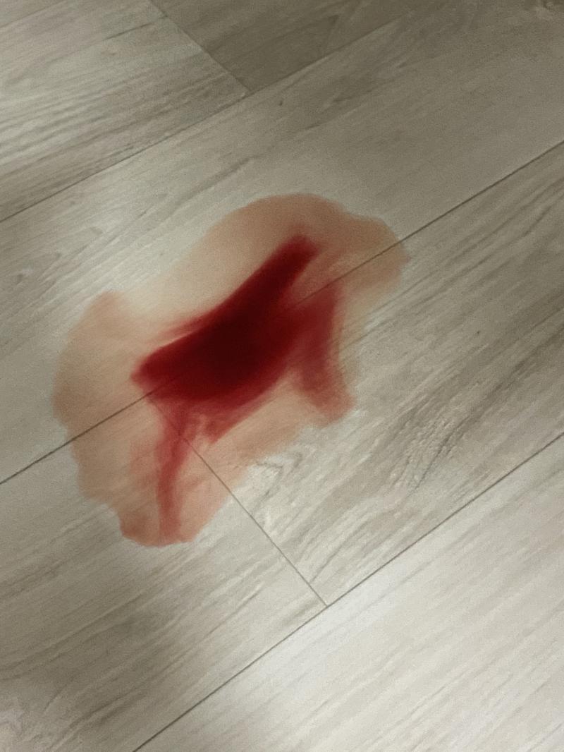 사진 첨부할게