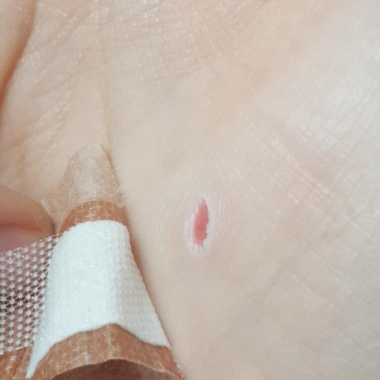 ㅅㅂ진짜 개아픔 레고밟는아픔이랑 차원이달라