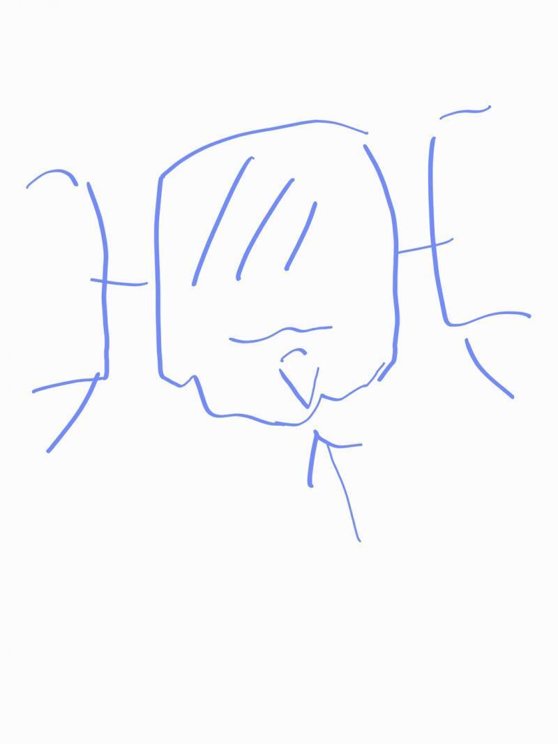 그림 처럼 뜬금없이 뾰족한게 아래로 솟아있었어 뜬금없이 저런게 왜 있담? 난 저 뾰족이가 너무 거슬렸어 저 뾰족이 때문에 음식을 씹을 때도 아래