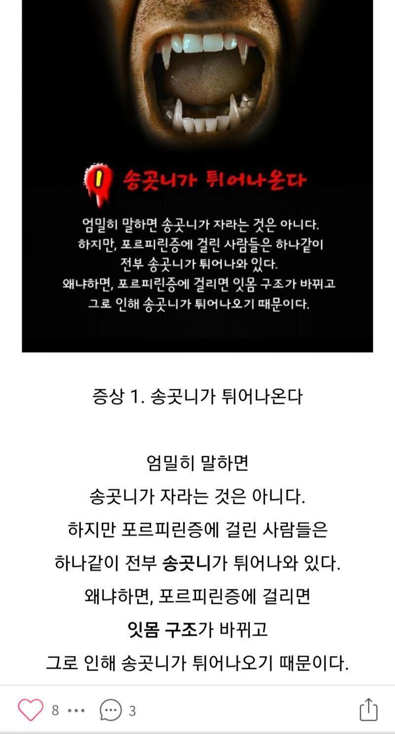 요런거?