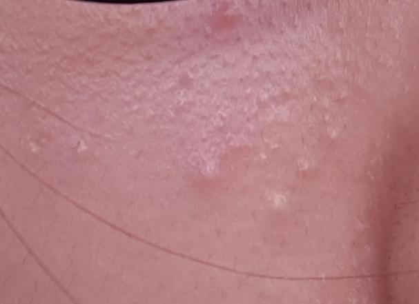 앞꺼는 얼굴이고 뒤쪽꺼는 다른 부위인데..ㅠㅠㅠㅠㅠㅠㅜ 좀 도와주라 +사람에따라서 좀 보기 그럴 수도 있겠다ㅠㅜ
