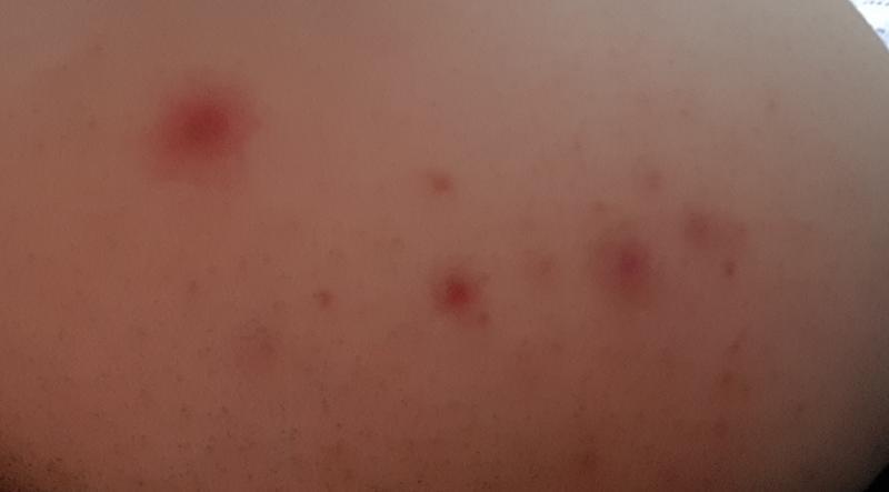앞꺼는 얼굴이고 뒤쪽꺼는 다른 부위인데..ㅠㅠㅠㅠㅠㅠㅜ 좀 도와주라 +사람에따라서 좀 보기 그럴 수도 있겠다ㅠㅜ