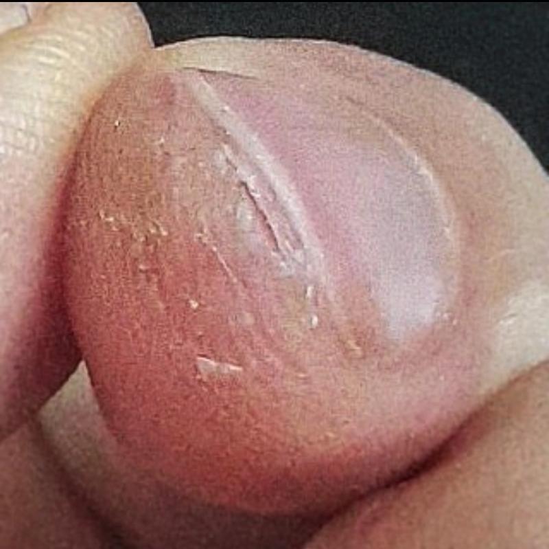 카메라 초점이 잘 안 잡혀서 최대한 실물처럼 보이게 했어... 실제로 보면 저거보다 더 깊게 많이(?)갈라졌는데 어떡해 진짜 개아파