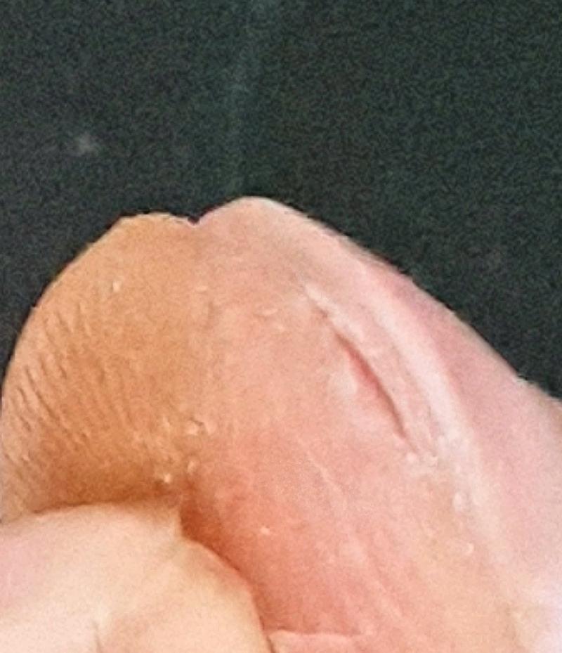 카메라 초점이 잘 안 잡혀서 최대한 실물처럼 보이게 했어... 실제로 보면 저거보다 더 깊게 많이(?)갈라졌는데 어떡해 진짜 개아파
