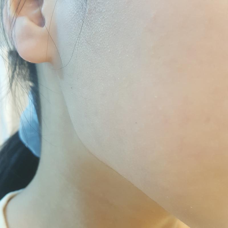 1일차 세안전 볼이랑 이마 요즘에 코로나때문에 어디 나가지도 않고 해서 제대로 안 씻었더니 이마가 좀 지저분해졌네 ㅋㅋㅋㅋ