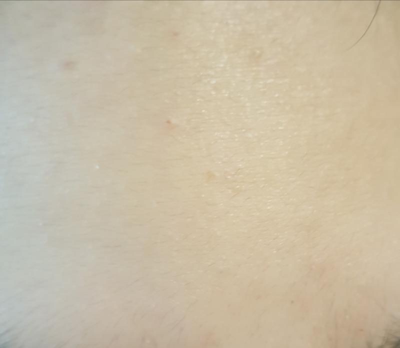 1일차 세안전 볼이랑 이마 요즘에 코로나때문에 어디 나가지도 않고 해서 제대로 안 씻었더니 이마가 좀 지저분해졌네 ㅋㅋㅋㅋ