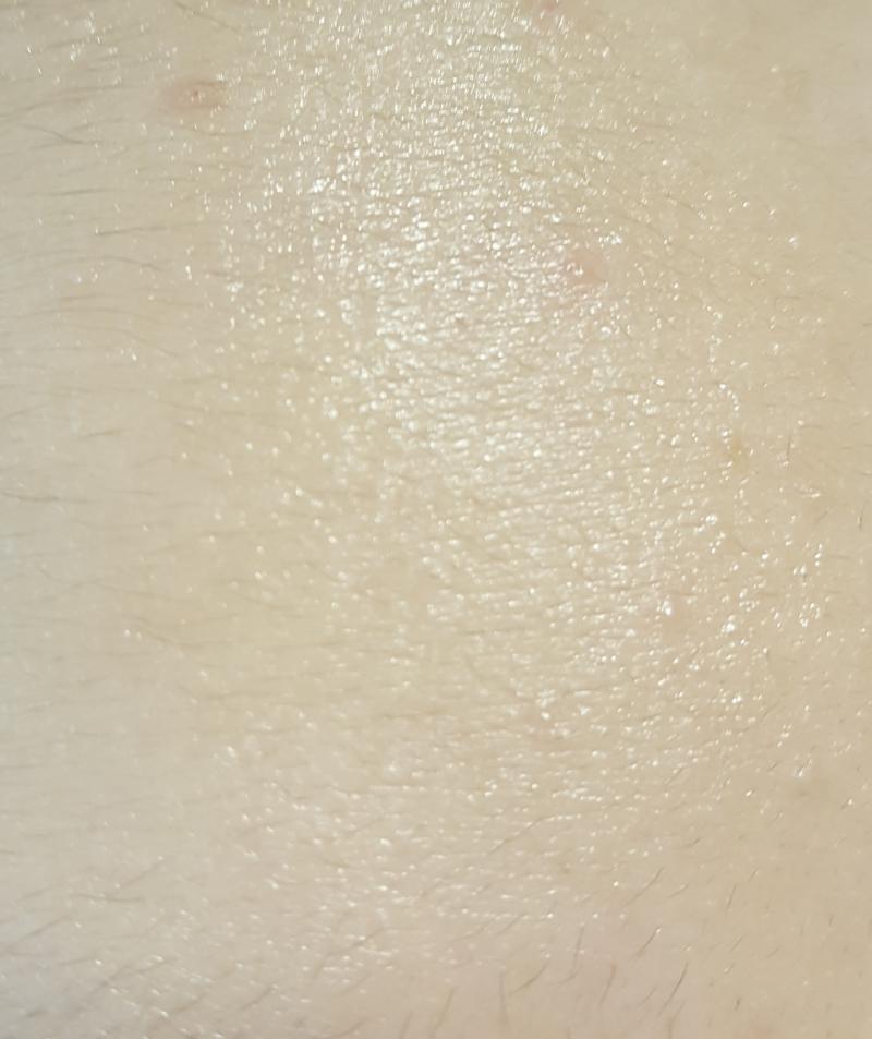 1일차 세안후+로션 역시 볼이랑 이마 마법의 비누도 아니고 세수 한 번으로 눈에 띄게 달라질 리는 없겠지
