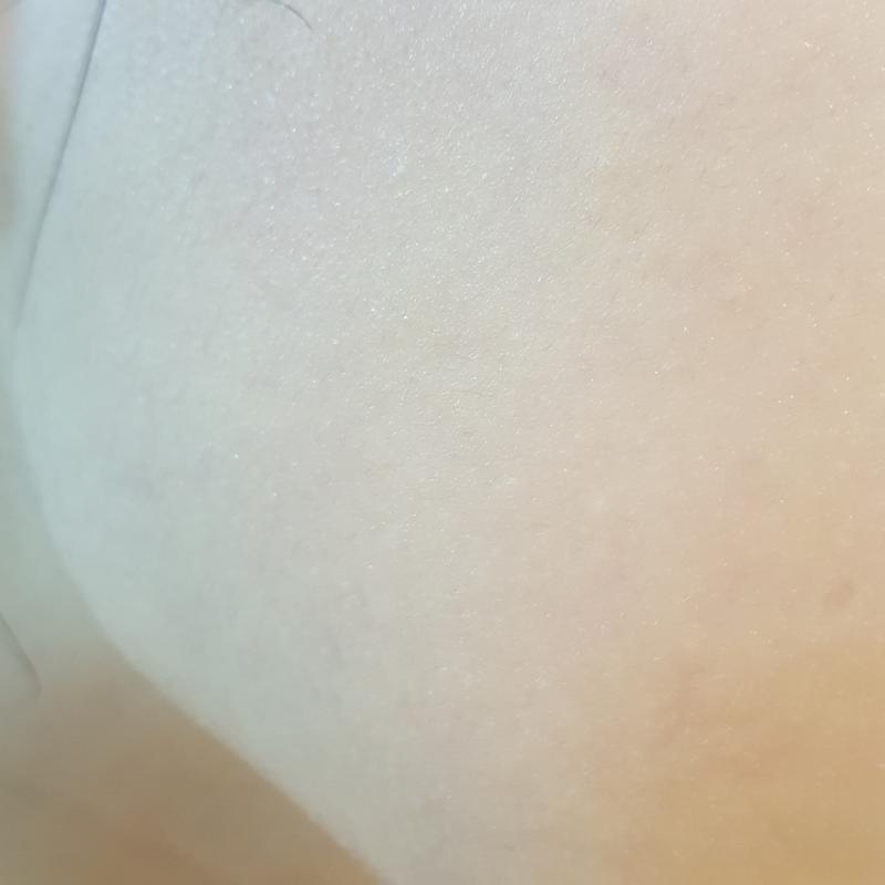 1일차 세안후+로션 역시 볼이랑 이마 마법의 비누도 아니고 세수 한 번으로 눈에 띄게 달라질 리는 없겠지