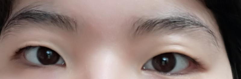 눈