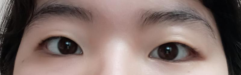 눈