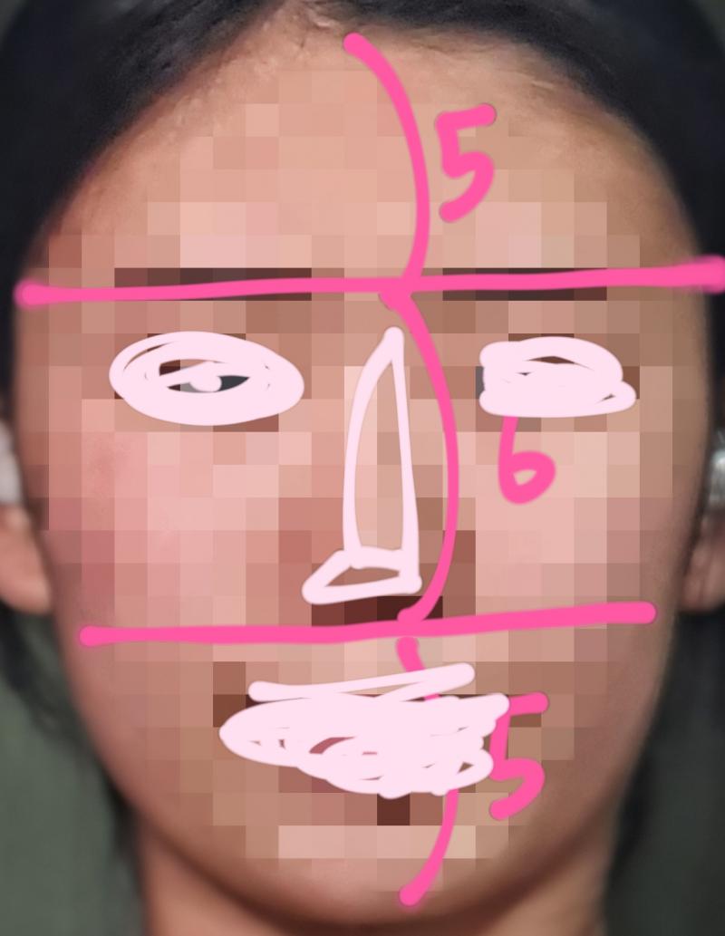 아 맞다 그리고 나 콘헤드 두상인 것 같어ㅓ