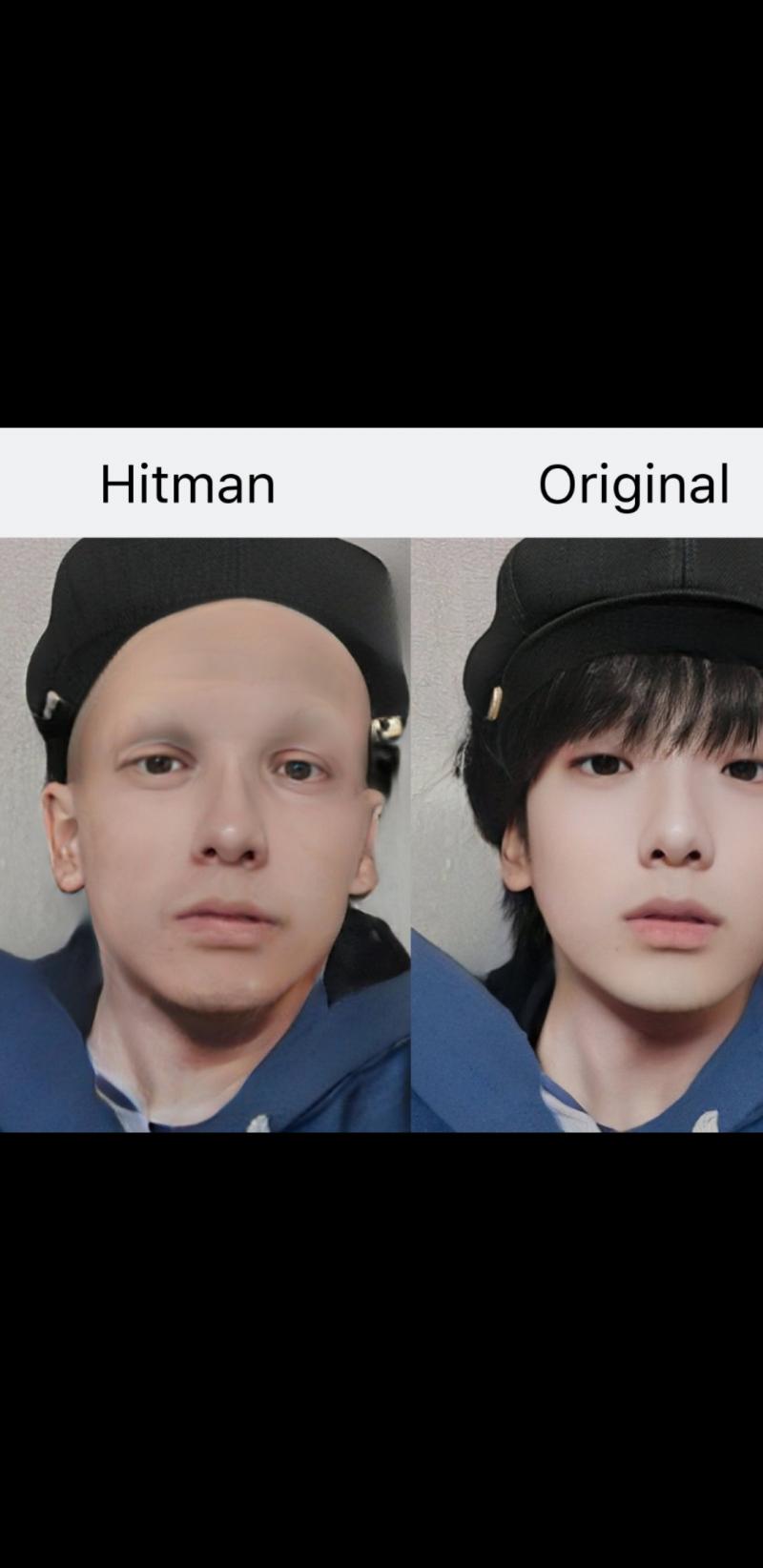 대머리도됨