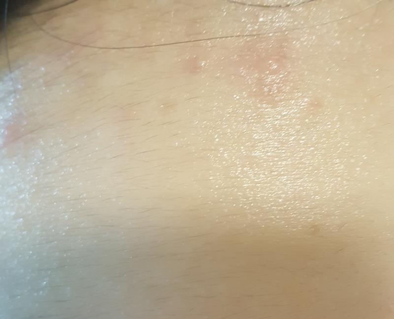 어제 까먹고 안 올렸다... 세수 후 사진이야! 사실 13일날 비누를 변기에 빠뜨려서 ^^... 어제 다시 받았어 ㅋㅋㅋㅋㅋㅋㅋ 이마가 갑자기