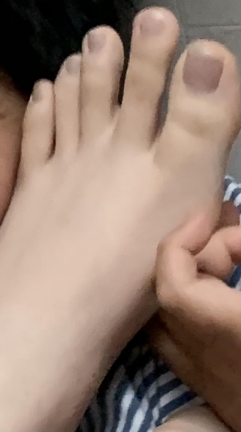 아 왜 사진에 안 담아지냐 이게 평상시 내 발이야