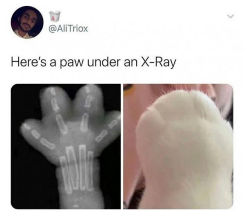 ์๋ฐฉ๋ง์ด x-ray