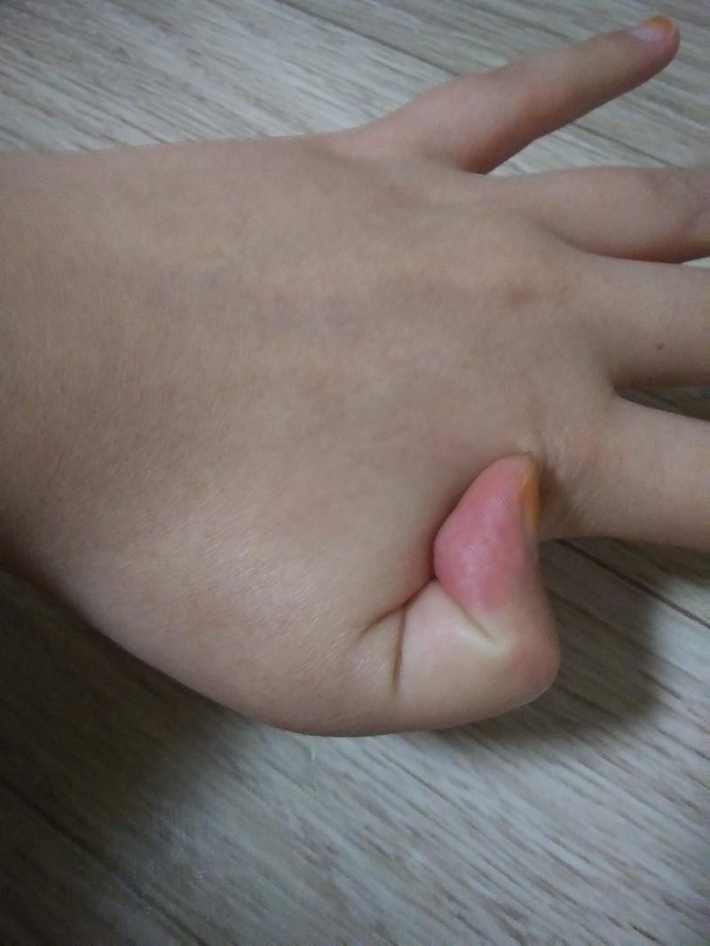 ㅋ