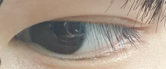 쌍수 하는 게 낫겟지...?