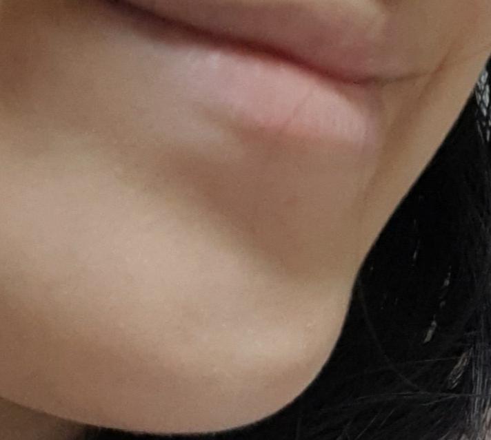 입웃음 좀만 지어도 저지랄남 진짜... 턱튀 개빡...쳐.. 쌩얼로 찍은건 양해좀 해줘잉