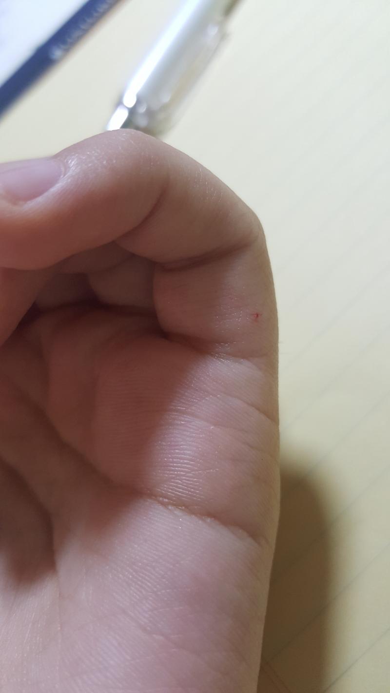 막 그렇게 심하게는 다치진 않았는데.. 그래두...ㅠㅠㅠ 이 고영희가 날 다치게 만들었단 이 말씀...!! 공격 안한다고 눈 마주칠 때 마다 눈