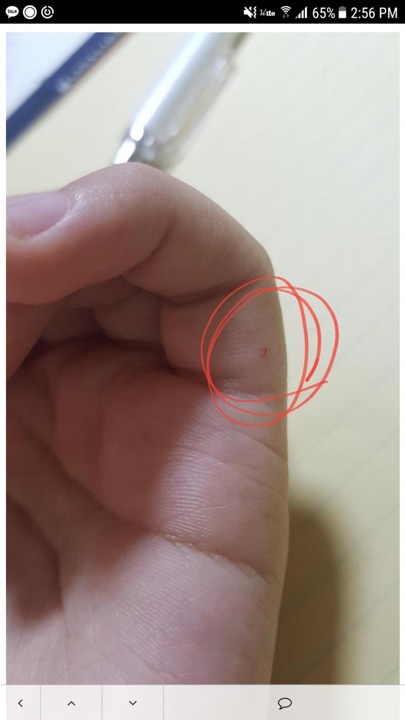상처가 안 보일 수도 있을 것 같아서 다시 첨부할게