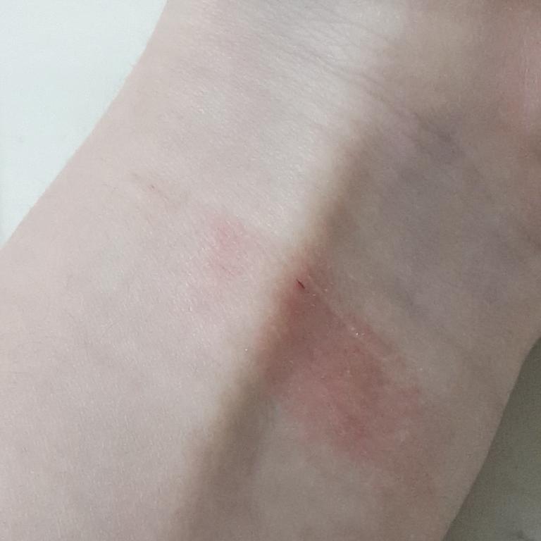 좀 막 거칠거칠하고 부어 ?있는데 아 사진은올리면안되나..? 여기온지얼마안되서 안되는거면 미안해 근데 이거 어떡해 아무도 모르는데 들키면안되거든