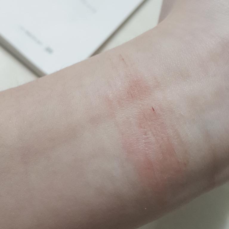 좀 막 거칠거칠하고 부어 ?있는데 아 사진은올리면안되나..? 여기온지얼마안되서 안되는거면 미안해 근데 이거 어떡해 아무도 모르는데 들키면안되거든